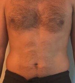 Miami Personal Training